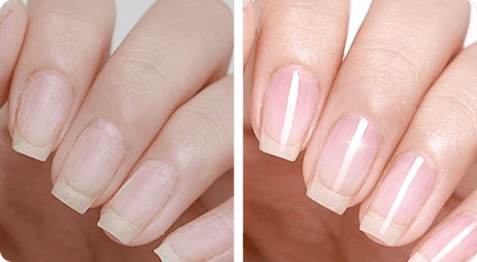 Neyl - Ge dina naglar nytt liv.